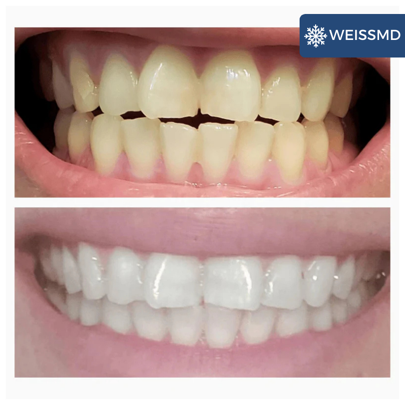 WEISSMD® Whitening Booster Pulver